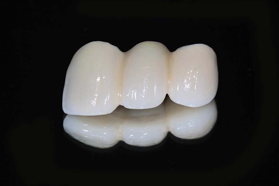 Couronne Full Zircone
