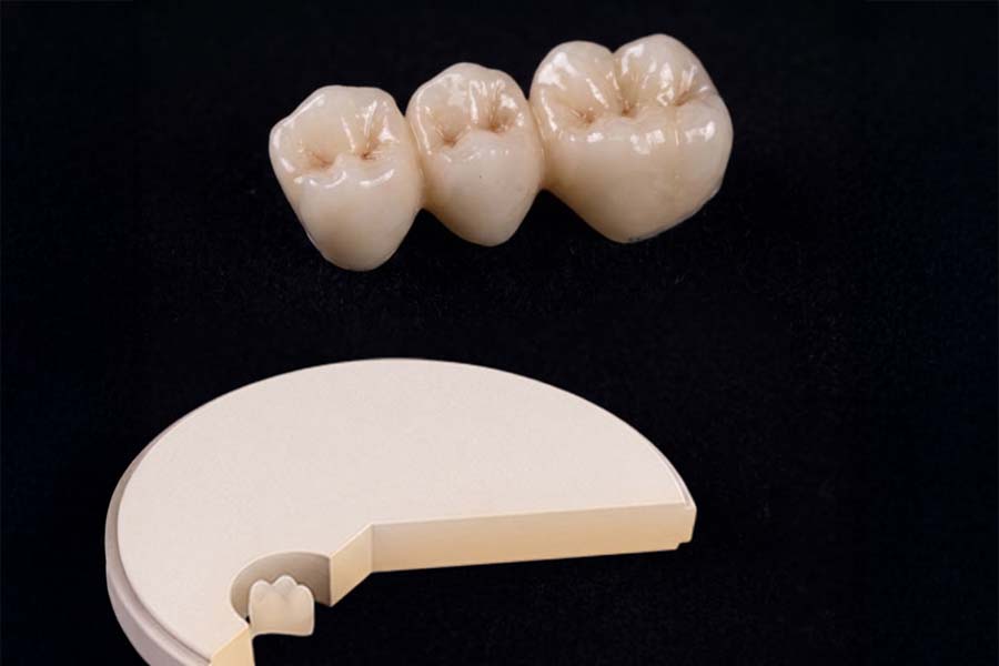 Couronne Full Zircone multicouches