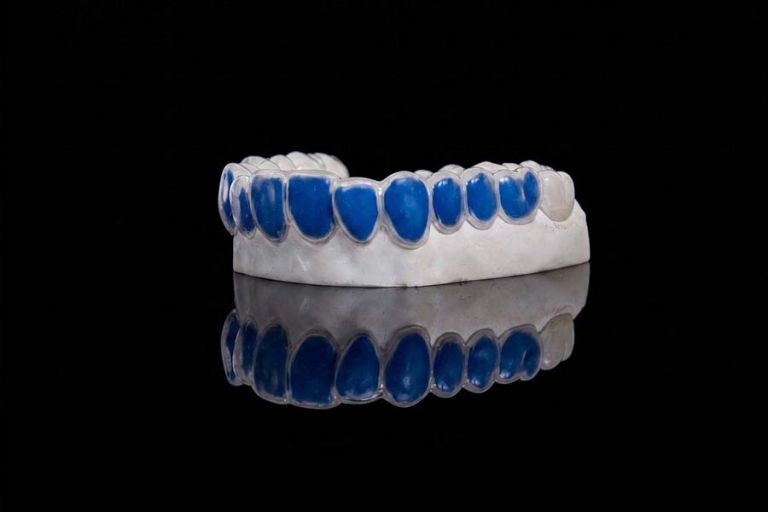 Gouttière de blanchiment