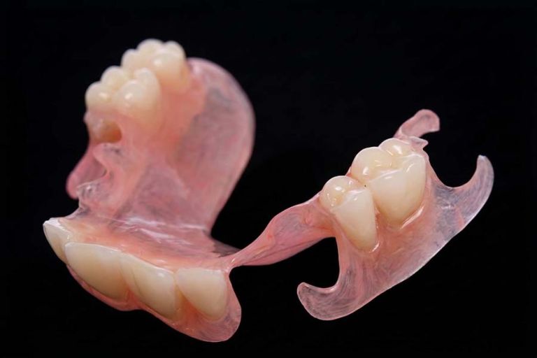 Prothèse résine flexible