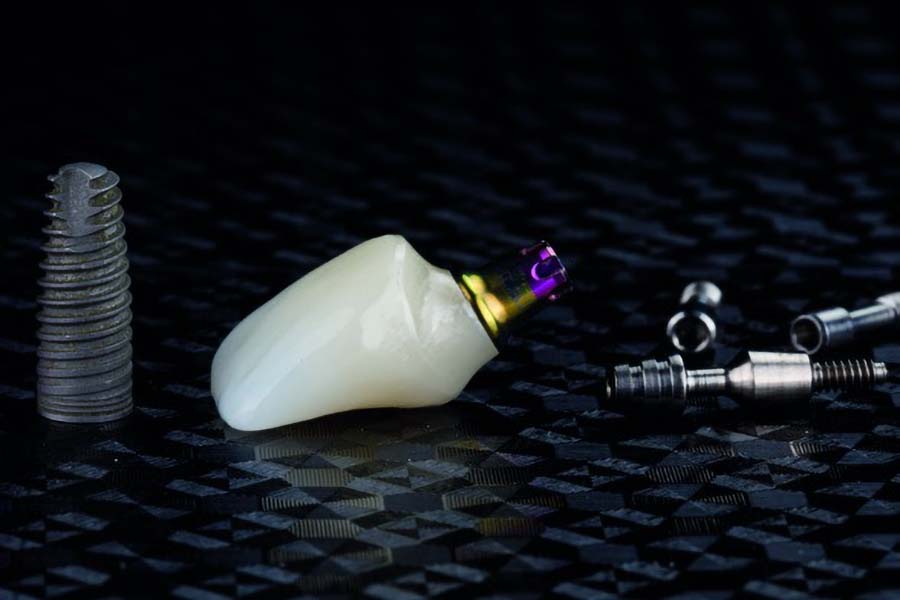 Prothèse transvissée sur implant
